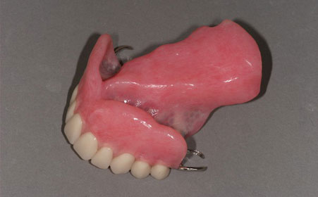 Maxillofacial Prosthesis