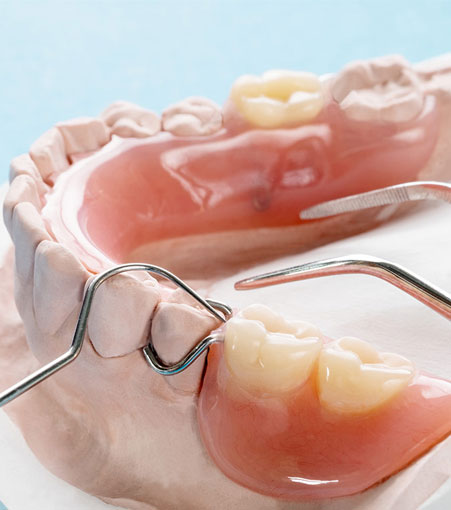 Fixed And Removable Denture Service