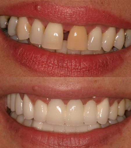 Cosmetic Dental Care