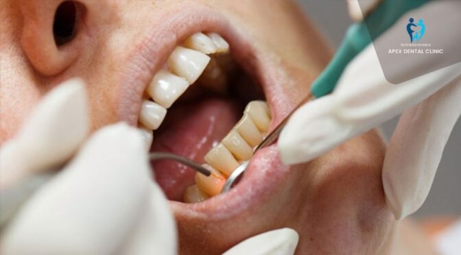 5 Smart Ways to Find the Best Local Dentists in Kolkata