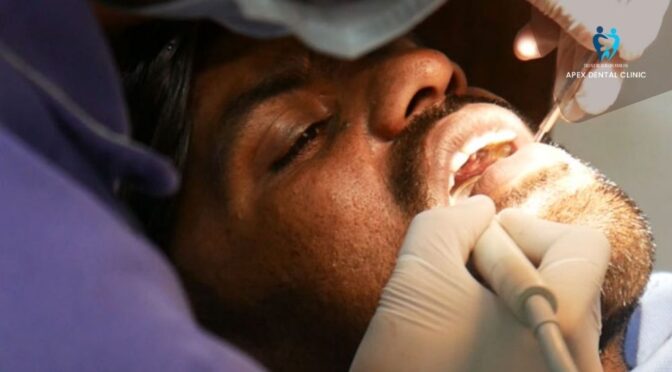 Know About The Major Role of Expert Dental Surgeons in Oral Healthcare
