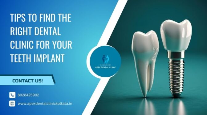 Tips to Find The Right Dental Clinic for Your Teeth Implant