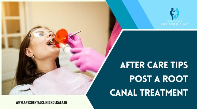 After Care Tips Post a Root Canal Treatment