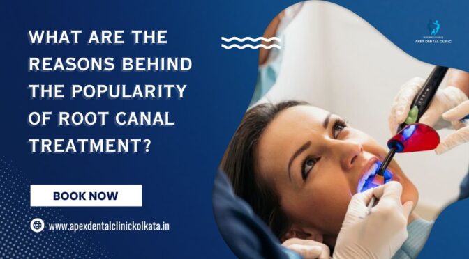 What are the Reasons Behind the Popularity of Root Canal Treatment?