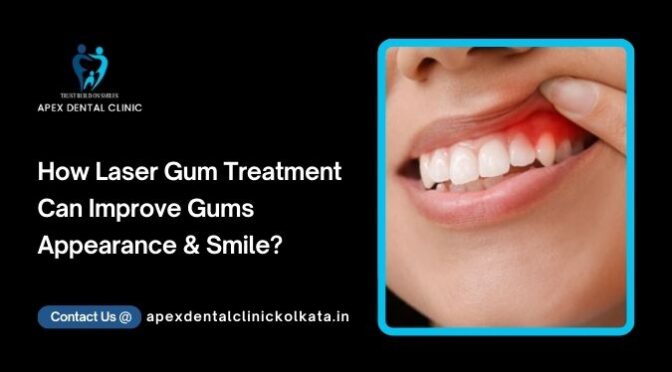 How Laser Gum Treatment Can Improve Gums Appearance & Smile?