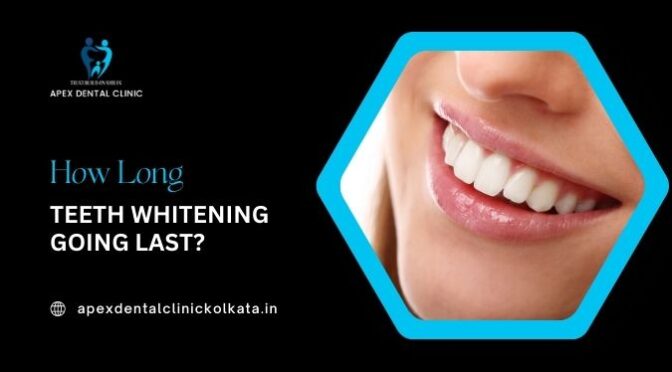 Is Teeth Whitening Treatment Permanent?